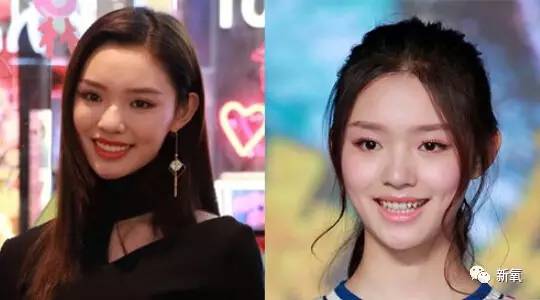 林允整牙却像整容？她是真的又整了啊！