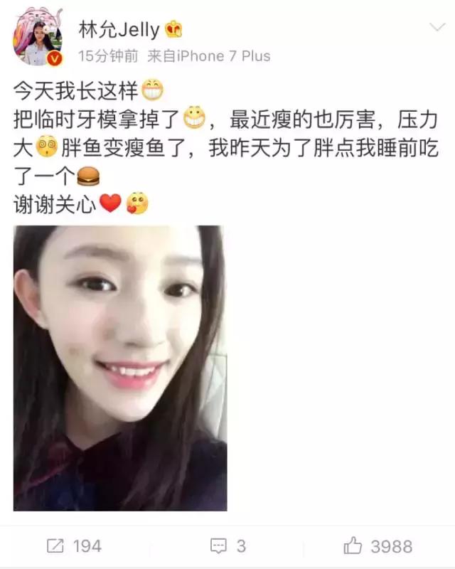 林允的牙怎么又恢复了,林允回应脸型变化她又变脸了吗