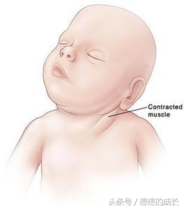 新生儿满月头必须得剃吗,宝宝剃满月头需要关注什么