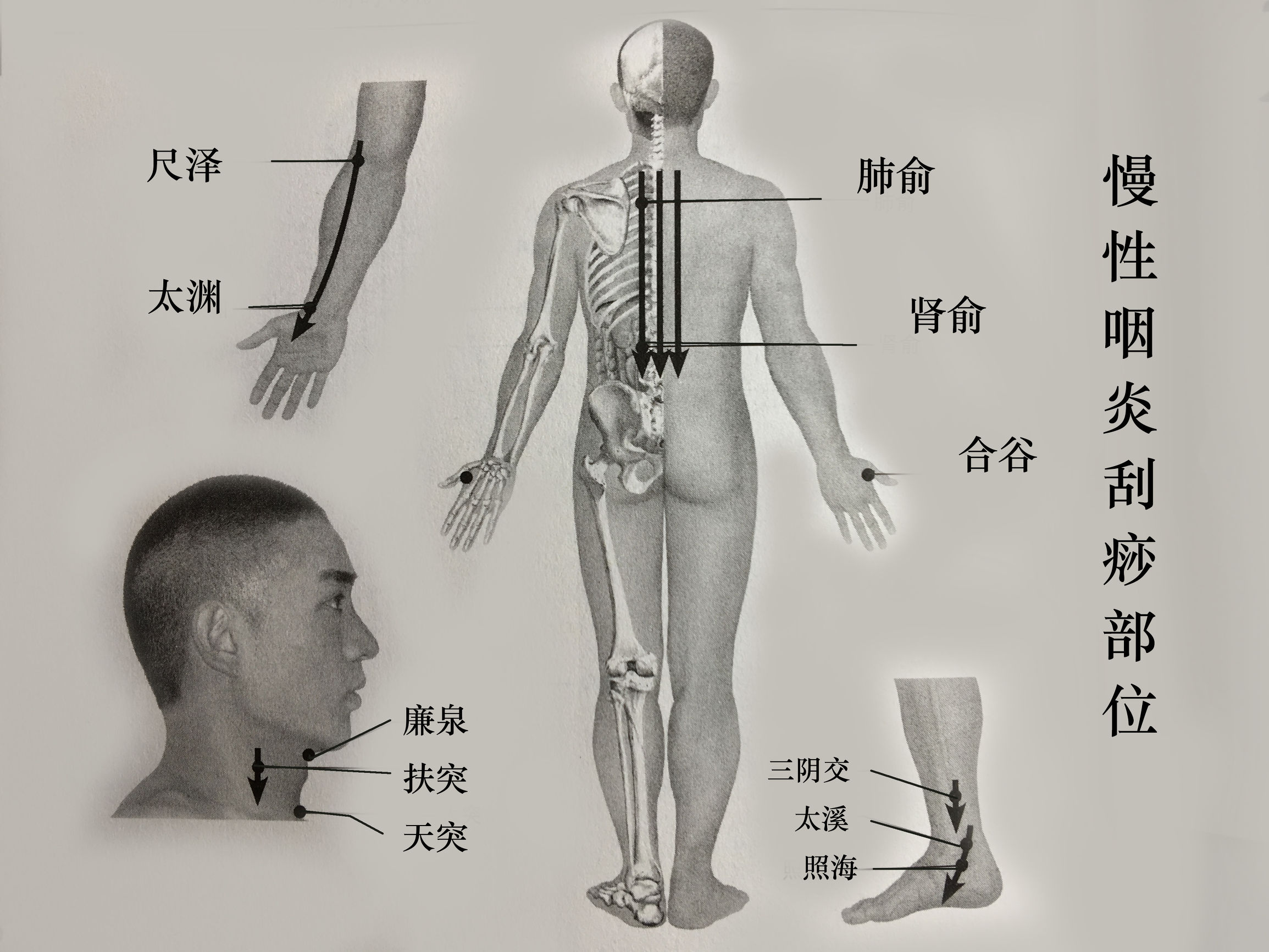 过敏性咽炎有哪些穴位,过敏性鼻炎和慢性咽炎刮痧方法