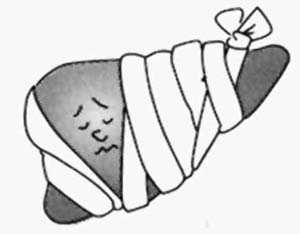 按什么穴位可以治疗脂肪肝,哪些穴位扎针可以治疗脂肪肝