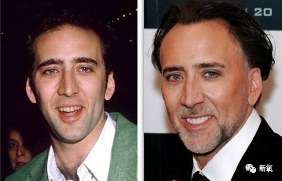 林允整牙却像整容？她是真的又整了啊！