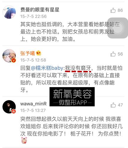 林允整牙却像整容？她是真的又整了啊！