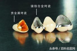 整牙可以变好看吗,整牙可以变成瓜子脸吗