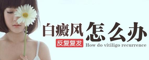 中亚研究所治疗白癜风,白癜风国家能攻克吗