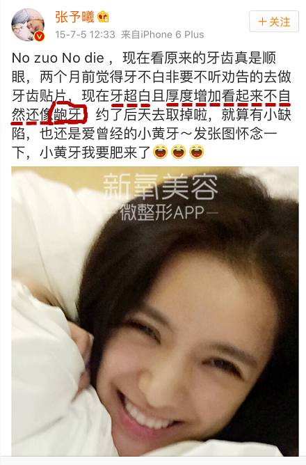 林允整牙却像整容？她是真的又整了啊！