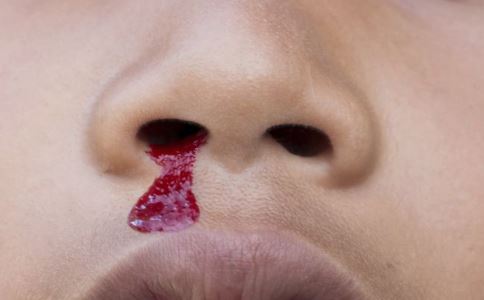 冬季流鼻血关注吃什么东西不上火,到了冬季老是流鼻血怎么回事