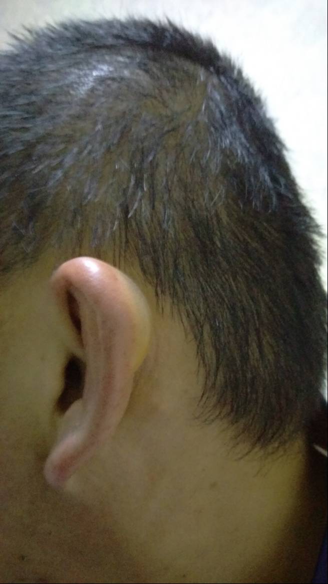 山东猪坚强,猪坚强512