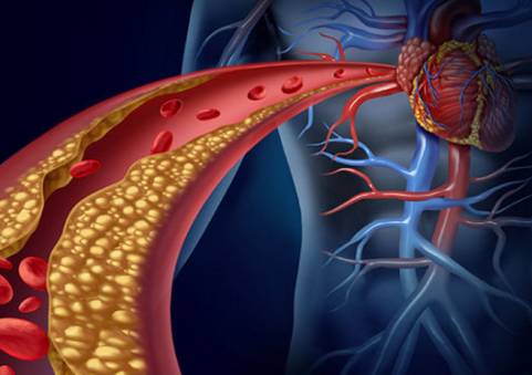 糖尿病性冠心病，如何治疗？