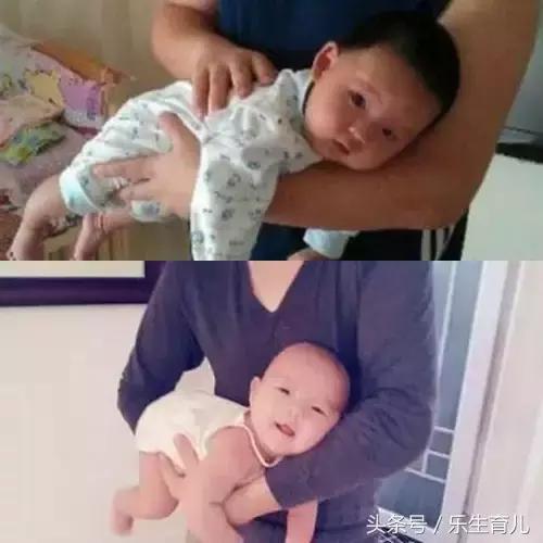 头丑随一生！千万别错过宝宝头型矫正黄金期