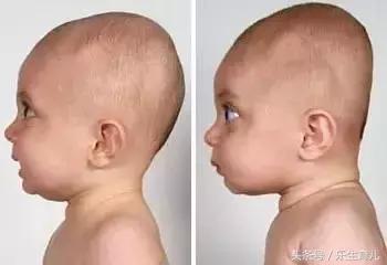 头丑随一生！千万别错过宝宝头型矫正黄金期