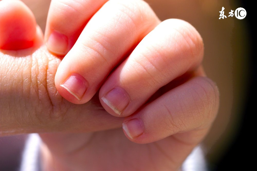 儿童几岁可以杀幽门螺杆菌,儿童感染幽门螺杆菌的症状