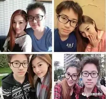 做超声刀要提前做什么准备,超声刀最佳效果时间