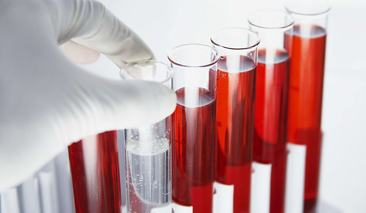 发现血尿,发现血尿后做什么检查