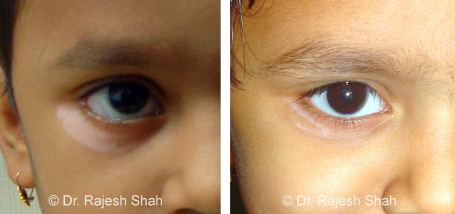 被医院皮肤科误诊了怎么办,皮肤科常见病褐色斑