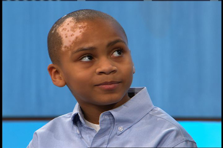 被医院皮肤科误诊了怎么办,皮肤科常见病褐色斑