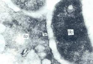 专家推荐治疗幽门螺杆菌,专家治疗幽门螺杆菌药方