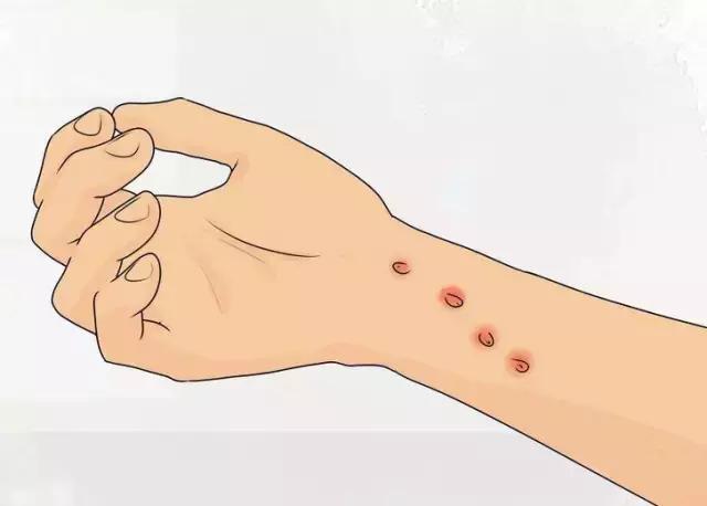 总被猫挠会得病吗,总是被猫抓破手怎么办