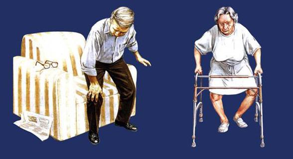 澳洲维骨力关节灵简介,维骨力治疗关节炎