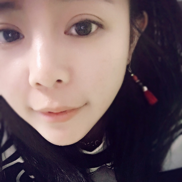 做完双眼皮眼睛像哭了一样,做完双眼皮哭了眼睛灰蒙蒙的