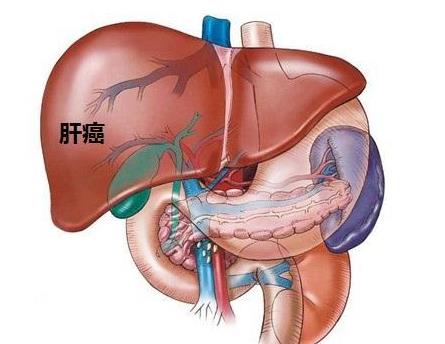 余祖江治肝炎,郑大一附院感染科余祖江挂号