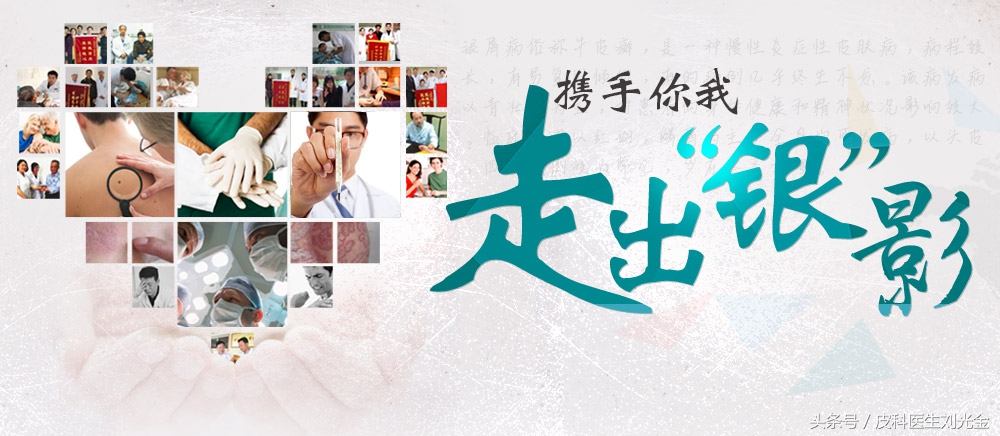 中医高志学,专家谈银屑病的治疗有效方法