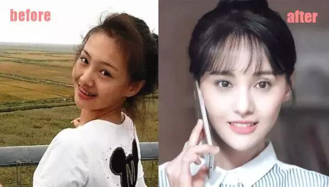 整牙刘涛,整牙改变脸型杨幂