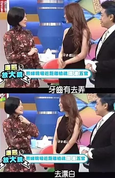 整牙刘涛,整牙改变脸型杨幂