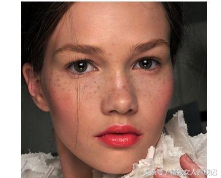 长斑皮肤的护理方案,皮肤长斑点