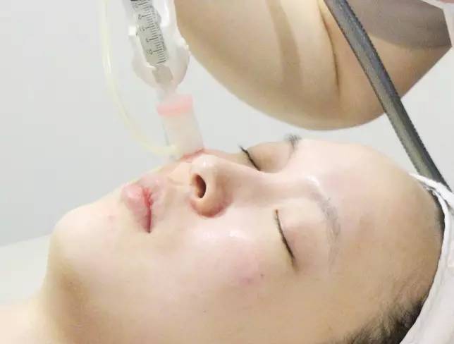 割双眼皮、垫鼻子、幽灵医生……一篇文章为你揭秘韩国整形