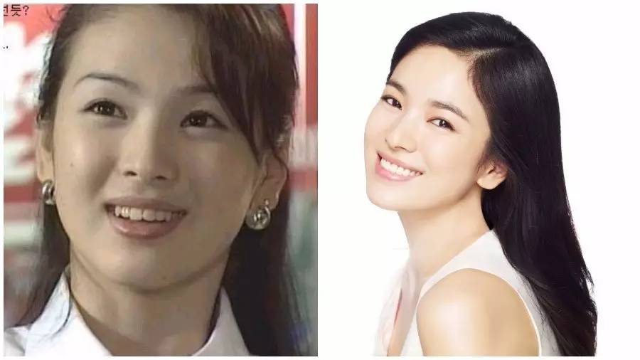 割双眼皮、垫鼻子、幽灵医生……一篇文章为你揭秘韩国整形