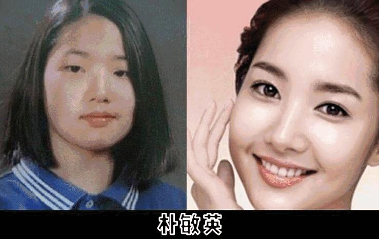 割双眼皮、垫鼻子、幽灵医生……一篇文章为你揭秘韩国整形