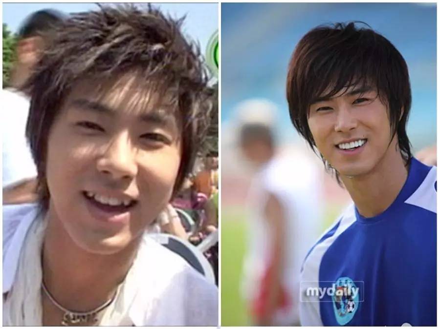 割双眼皮、垫鼻子、幽灵医生……一篇文章为你揭秘韩国整形