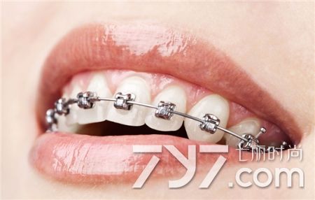 拔牙后关注事项最全,拔牙后关注事项全知道