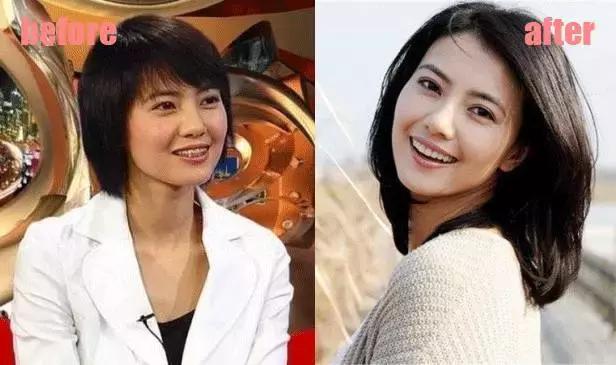 整牙刘涛,整牙改变脸型杨幂