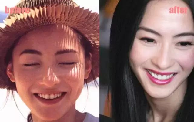整牙刘涛,整牙改变脸型杨幂