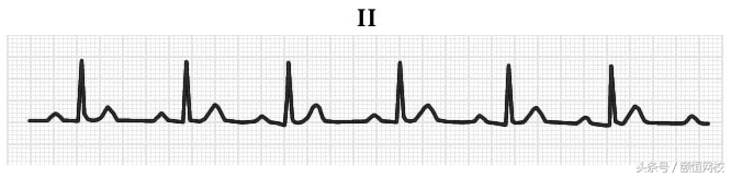 郭雅卿心电图讲解全集,郭雅卿心血管视频课
