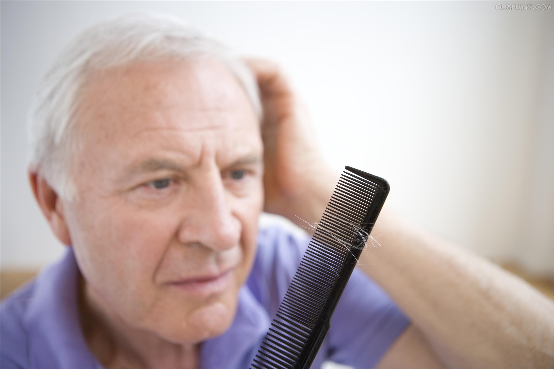 脱发头发养护知识大全,拯救脱发少女的专属养发秘籍