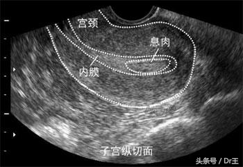 结婚五年没怀孕到底怎么治,结婚五年肚子没动