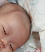 如何确定是不是狭颅症,狭颅症是什么东西