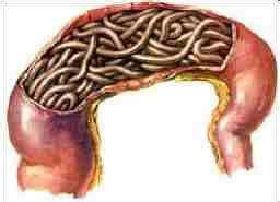 小孩肚子里有蛔虫如何处理,孩子肚里有虫子怎么根治