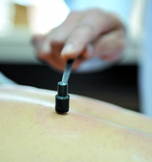 头部脂溢性皮炎，头油，头痒，头屑多，中医用1种针具扣刺