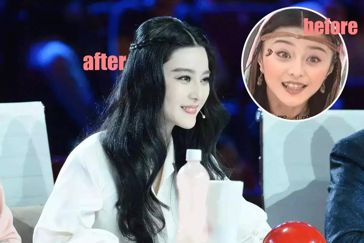 整牙刘涛,整牙改变脸型杨幂