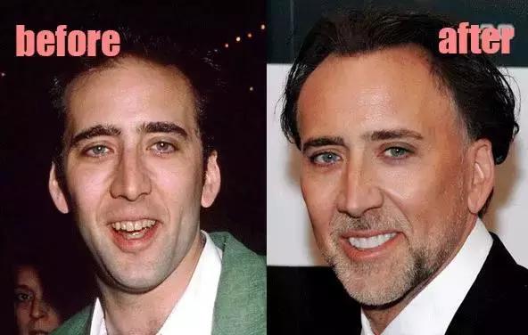 整牙刘涛,整牙改变脸型杨幂