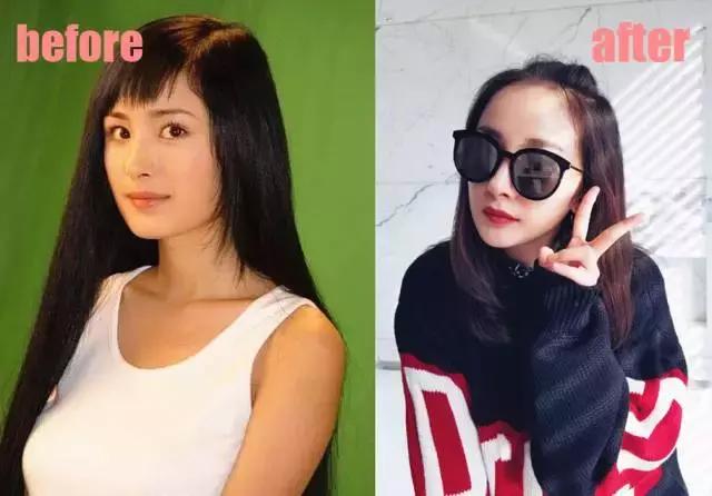 整牙刘涛,整牙改变脸型杨幂