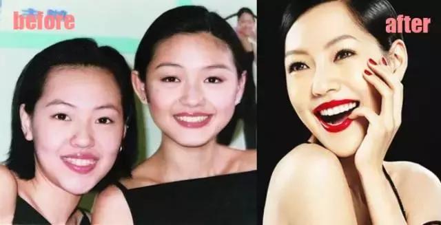 整牙刘涛,整牙改变脸型杨幂