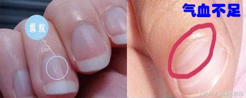 自测气血不够小妙招,如何看气血不够在身体的表现