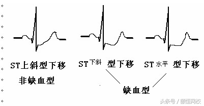 郭雅卿心电图讲解全集,郭雅卿心血管视频课