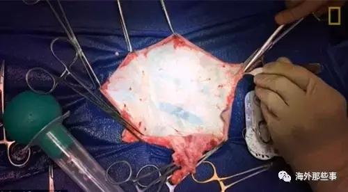 她允许摄影师跟拍变性全过程获得全家支持