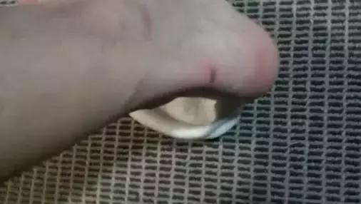 踢球脚大拇指总是磨起泡是为什么,踢球脚起泡是怎么回事